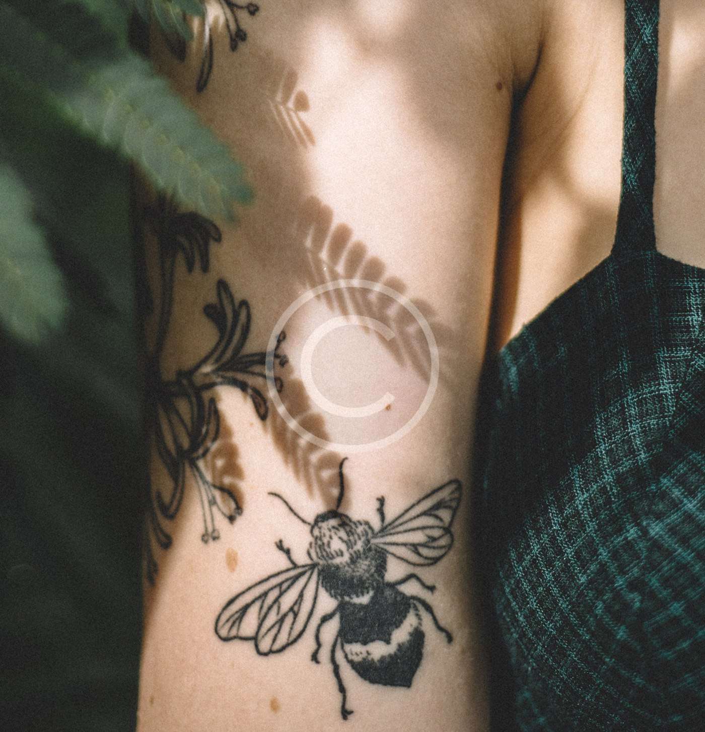 Détatouage au Laser